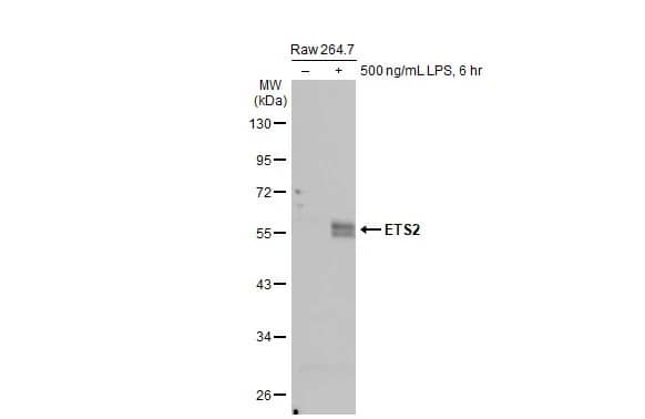 <b>Biological Strategies Validation. </b>Western Blot: ETS2 Antibody (HL2259) - Azide and BSA Free [NBP3-25458] - Untreated (-) and treated (+) Raw 264.7 whole cell extracts (30 ug) were separated by 10% SDS-PAGE, and the membrane was blotted with ETS2 antibody [HL2259] (NBP3-25458) diluted at 1:1000. The HRP-conjugated anti-rabbit IgG antibody was used to detect the primary antibody, and the signal was developed with Trident ECL plus-Enhanced.