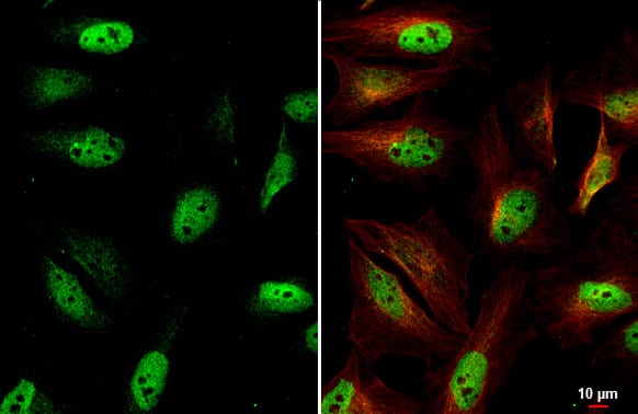 Immunocytochemistry/Immunofluorescence: ETS2 Antibody (HL2259) - Azide and BSA Free [NBP3-25458] - ETS2 antibody [HL2259] detects ETS2 protein at cytoplasm and nucleus by immunofluorescent analysis. Sample: HeLa cells were fixed in 4% paraformaldehyde at RT for 15 min. Green: ETS2 stained by ETS2 antibody [HL2259] (NBP3-25458) diluted at 1:500. Red: alpha Tubulin, a cytoskeleton marker, stained by alpha Tubulin antibody [GT114] diluted at 1:1000.