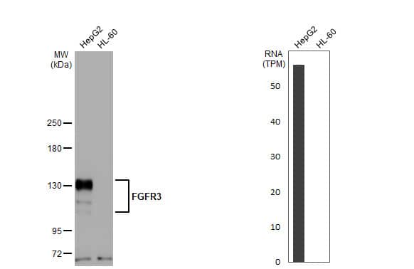 Western Blot: FGFR3 Antibody (HL1595) - Azide and BSA Free [NBP3-25465] - Various whole cell extracts (30 ug) were separated by 5% SDS-PAGE, and the membrane was blotted with FGFR3 antibody [HL1595] (NBP3-25465) diluted at 1:2000. The HRP-conjugated anti-rabbit IgG antibody was used to detect the primary antibody.