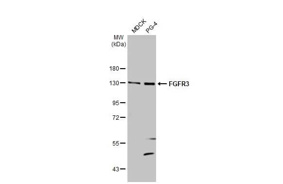 Western Blot: FGFR3 Antibody (HL1595) - Azide and BSA Free [NBP3-25465] - Various whole cell extracts (30 ug) were separated by 7.5% SDS-PAGE, and the membrane was blotted with FGFR3 antibody [HL1595] (NBP3-25465) diluted at 1:500. The HRP-conjugated anti-rabbit IgG antibody was used to detect the primary antibody.