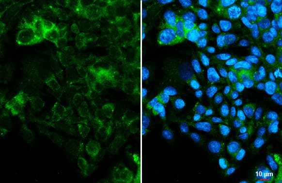 <b>Orthogonal Strategies Validation. </b>Immunocytochemistry/Immunofluorescence: Hepassocin/FGL1 Antibody (HL2317) - Azide and BSA Free [NBP3-25466] - FGL1 antibody [HL2317] detects FGL1 protein at cytoplasm by immunofluorescent analysis. Sample: HepG2 cells were fixed in 4% paraformaldehyde at RT for 15 min. Green: FGL1 stained by FGL1 antibody [HL2317] (NBP3-25466) diluted at 1:250. Blue: Fluoroshield with DAPI .