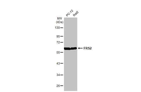 Western Blot: FRS2 Antibody (HL1774) - Azide and BSA Free [NBP3-25470] - Various whole cell extracts (30 ug) were separated by 10% SDS-PAGE, and the membrane was blotted with FRS2 antibody [HL1774] (NBP3-25470) diluted at 1:1000. The HRP-conjugated anti-rabbit IgG antibody was used to detect the primary antibody.