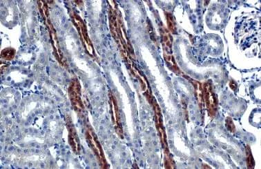 Immunohistochemistry-Paraffin: FRS2 Antibody (HL1774) - Azide and BSA Free [NBP3-25470] - FRS2 antibody [HL1774] detects FRS2 protein at cytoplasm by immunohistochemical analysis. Sample: Paraffin-embedded mouse kidney. FRS2 stained by FRS2 antibody [HL1774] (NBP3-25470) diluted at 1:100. Antigen Retrieval: Citrate buffer, pH 6.0, 15 min