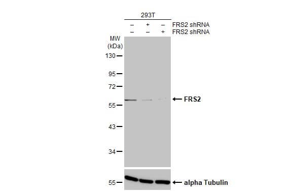 <b>Genetic Strategies Validation. </b>Knockdown Validated: FRS2 Antibody (HL1774) - Azide and BSA Free [NBP3-25470] - Non-transfected (-) and transfected (+) 293T whole cell extracts (30 ug) were separated by 10% SDS-PAGE, and the membrane was blotted with FRS2 antibody [HL1774] (NBP3-25470) diluted at 1:50000. The HRP-conjugated anti-rabbit IgG antibody was used to detect the primary antibody.