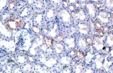 Immunohistochemistry-Paraffin: FRS2 Antibody (HL1774) - Azide and BSA Free [NBP3-25470] - FRS2 antibody [HL1774] detects FRS2 protein at cytoplasm by immunohistochemical analysis. Sample: Paraffin-embedded rat kidney. FRS2 stained by FRS2 antibody [HL1774] (NBP3-25470) diluted at 1:100. Antigen Retrieval: Citrate buffer, pH 6.0, 15 min