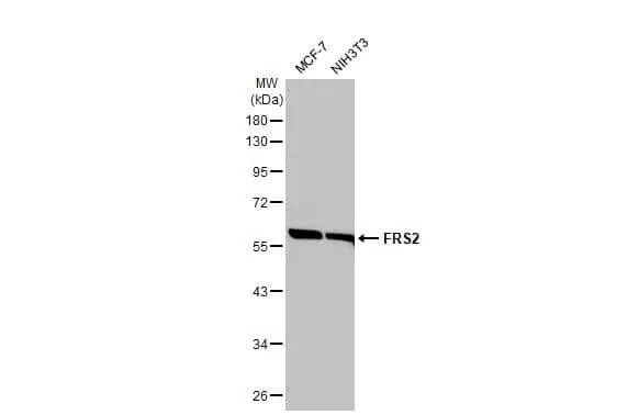 Western Blot: FRS2 Antibody (HL1774) - Azide and BSA Free [NBP3-25470] - Various whole cell extracts (30 ug) were separated by 10% SDS-PAGE, and the membrane was blotted with FRS2 antibody [HL1774] (NBP3-25470) diluted at 1:5000. The HRP-conjugated anti-rabbit IgG antibody was used to detect the primary antibody.