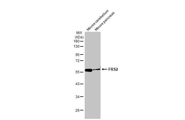 Western Blot: FRS2 Antibody (HL1774) - Azide and BSA Free [NBP3-25470] - Various tissue extracts (50 ug) were separated by 10% SDS-PAGE, and the membrane was blotted with FRS2 antibody [HL1774] (NBP3-25470) diluted at 1:5000. The HRP-conjugated anti-rabbit IgG antibody was used to detect the primary antibody.