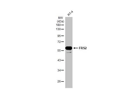 Western Blot: FRS2 Antibody (HL1774) - Azide and BSA Free [NBP3-25470] - Whole cell extract (30 ug) was separated by 10% SDS-PAGE, and the membrane was blotted with FRS2 antibody [HL1774] (NBP3-25470) diluted at 1:5000. The HRP-conjugated anti-rabbit IgG antibody was used to detect the primary antibody.