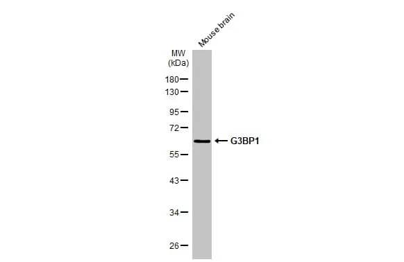 Western Blot: G3BP1 Antibody (HL2254) - Azide and BSA Free [NBP3-25472] - Mouse tissue extract (50 ug) was separated by 10% SDS-PAGE, and the membrane was blotted with G3BP1 antibody [HL2254] (NBP3-25472) diluted at 1:1000. The HRP-conjugated anti-rabbit IgG antibody was used to detect the primary antibody.