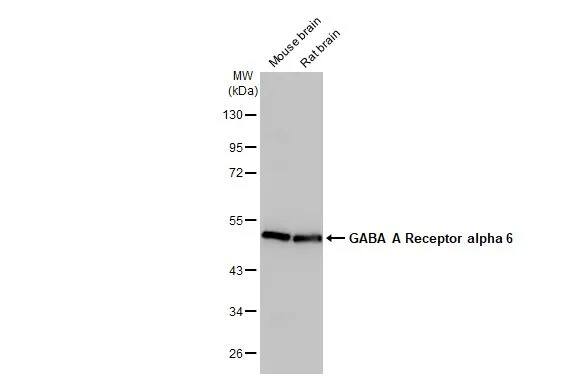 Western Blot: GABA-AR alpha 6 Antibody (HL1669) - Azide and BSA Free [NBP3-25473] - Various tissue extracts (50 ug) were separated by 10% SDS-PAGE, and the membrane was blotted with GABA A Receptor alpha 6 antibody [HL1669] (NBP3-25473) diluted at 1:1000. The HRP-conjugated anti-rabbit IgG antibody was used to detect the primary antibody.