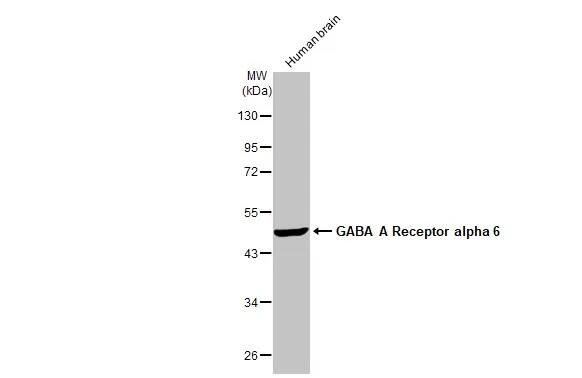 Western Blot: GABA-AR alpha 6 Antibody (HL1669) - Azide and BSA Free [NBP3-25473] - Human tissue extract (30 ug) was separated by 10% SDS-PAGE, and the membrane was blotted with GABA A Receptor alpha 6 antibody [HL1669] (NBP3-25473) diluted at 1:1000. The HRP-conjugated anti-rabbit IgG antibody was used to detect the primary antibody.