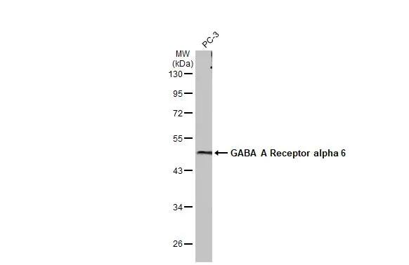 Western Blot: GABA-AR alpha 6 Antibody (HL1669) - Azide and BSA Free [NBP3-25473] - Whole cell extract (30 Aug) was separated by 10% SDS-PAGE, and the membrane was blotted with GABA A Receptor alpha 6 antibody [HL1669] (NBP3-25473) diluted at 1:1000. The HRP-conjugated anti-rabbit IgG antibody was used to detect the primary antibody, and the signal was developed with Trident ECL plus-Enhanced.