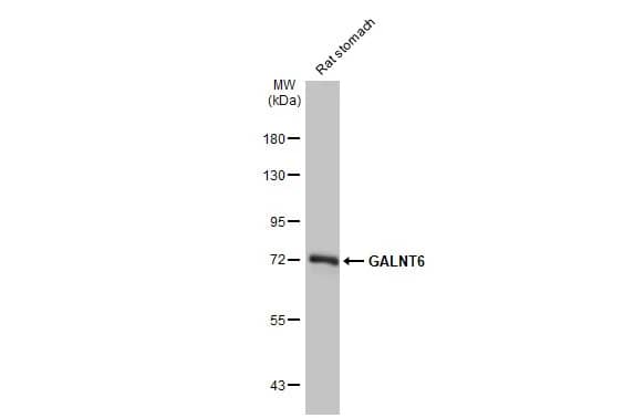 Western Blot: GALNT6 Antibody (HL2392) - Azide and BSA Free [NBP3-25475] - Rat tissue extract (50 ug) was separated by 7.5% SDS-PAGE, and the membrane was blotted with GALNT6 antibody [HL2392] (NBP3-25475) diluted at 1:1000. The HRP-conjugated anti-rabbit IgG antibody was used to detect the primary antibody.