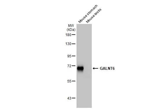 Western Blot: GALNT6 Antibody (HL2392) - Azide and BSA Free [NBP3-25475] - Various tissue extracts (50 ug) were separated by 7.5% SDS-PAGE, and the membrane was blotted with GALNT6 antibody [HL2392] (NBP3-25475) diluted at 1:1000. The HRP-conjugated anti-rabbit IgG antibody was used to detect the primary antibody.