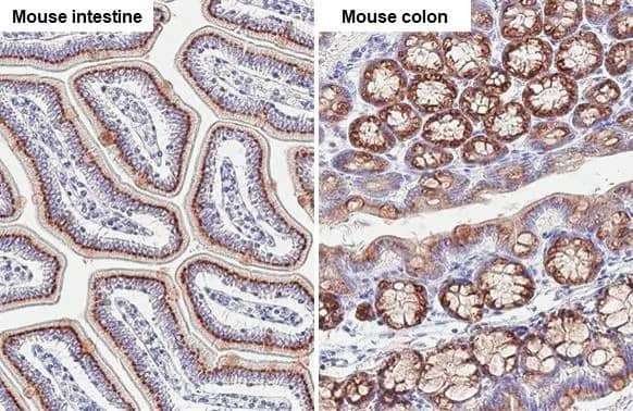 Immunohistochemistry-Paraffin GALNT6 Antibody (HL2392) - Azide and BSA Free