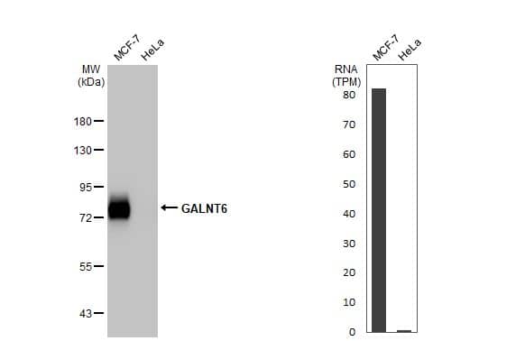 <b>Orthogonal Strategies Validation. </b>Western Blot: GALNT6 Antibody (HL2392) - Azide and BSA Free [NBP3-25475] - Various whole cell extracts (30 ug) were separated by 7.5% SDS-PAGE, and the membrane was blotted with GALNT6 antibody [HL2392] (NBP3-25475) diluted at 1:1000. The HRP-conjugated anti-rabbit IgG antibody was used to detect the primary antibody. Corresponding RNA expression data for the same cell lines are based on Human Protein Atlas program.