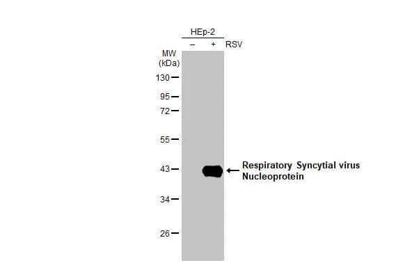 Non-infected (-) and infected (+) HEp-2 whole cell extracts were separated by 10% SDS-PAGE, and the membrane was blotted with Respiratory Syncytial virus Nucleoprotein antibody [HL1296] (NBP3-25479) diluted at 1:1000. The HRP-conjugated anti-rabbit IgG antibody  was used to detect the primary antibody. 