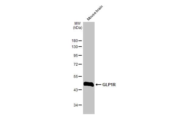 Western Blot: GLP-1R Antibody (HL2297) - Azide and BSA Free [NBP3-25482] - Mouse tissue extract (50 ug) was separated by 10% SDS-PAGE, and the membrane was blotted with GLP-1R antibody [HL2297] (NBP3-25482) diluted at 1:1000. The HRP-conjugated anti-rabbit IgG antibody  was used to detect the primary antibody.