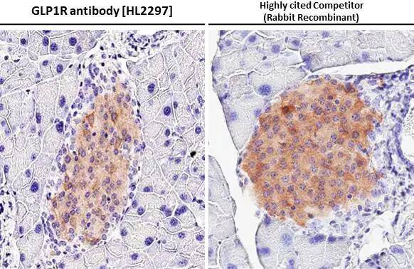 GLP1R antibody [HL2297] detects GLP1R protein at cell membrane and cytoplasm by immunohistochemical analysis.Sample: Paraffin-embedded mouse pancreas.GLP1R stained by GLP1R antibody [HL2297] (NBP3-25482) diluted at 1:2000 and competitor's antibody (ab218532) diluted at 1:2000.Antigen Retrieval: Citrate buffer, pH 6.0, 15 min*Competitor's antibody is not affiliated with Novus and does not endorse this product. 