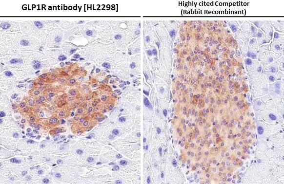 GLP1R antibody [HL2298] detects GLP1R protein at cell membrane and cytoplasm by immunohistochemical analysis.Sample: Paraffin-embedded mouse pancreas.GLP1R stained by GLP1R antibody [HL2298] (NBP3-25483) diluted at 1:2000 and competitor's antibody (ab218532) diluted at 1:2000.Antigen Retrieval: Citrate buffer, pH 6.0, 15 min*Competitor's antibody is not affiliated with Novus and does not endorse this product. 