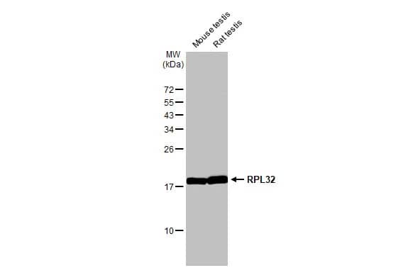 Western Blot: RPL32 Antibody (HL2329) - Azide and BSA Free [NBP3-25485] - Various tissue extracts (50 ug) were separated by 15% SDS-PAGE, and the membrane was blotted with RPL32 antibody [HL2329] (NBP3-25485) diluted at 1:1000. The HRP-conjugated anti-rabbit IgG antibody was used to detect the primary antibody.