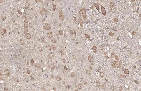 Immunohistochemistry-Paraffin: RPL32 Antibody (HL2329) - Azide and BSA Free [NBP3-25485] - RPL32 antibody [HL2329] detects RPL32 protein at cytoplasm by immunohistochemical analysis. Sample: Paraffin-embedded mouse brain. RPL32 stained by RPL32 antibody [HL2329] (NBP3-25485) diluted at 1:100. Antigen Retrieval: Citrate buffer, pH 6.0, 15 min