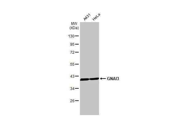 Western Blot: GNAI3 Antibody (HL2096) - Azide and BSA Free [NBP3-25487] - Various whole cell extracts (30 ug) were separated by 10% SDS-PAGE, and the membrane was blotted with GNAI3 antibody [HL2096] (NBP3-25487) diluted at 1:1000. The HRP-conjugated anti-rabbit IgG antibody was used to detect the primary antibody.