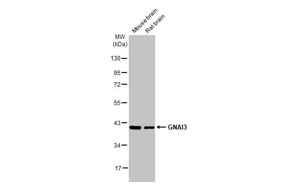 Western Blot: GNAI3 Antibody (HL2096) - Azide and BSA Free [NBP3-25487] - Various tissue extracts (50 ug) were separated by 10% SDS-PAGE, and the membrane was blotted with GNAI3 antibody [HL2096] (NBP3-25487) diluted at 1:1000. The HRP-conjugated anti-rabbit IgG antibody was used to detect the primary antibody, and the signal was developed with Trident ECL plus-Enhanced.