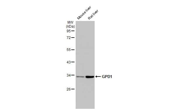 Western Blot: GPD1 Antibody (HL1959) - Azide and BSA Free [NBP3-25488] - Various tissue extracts (50 ug) were separated by 10% SDS-PAGE, and the membrane was blotted with GPD1 antibody [HL1959] (NBP3-25488) diluted at 1:5000. The HRP-conjugated anti-rabbit IgG antibody was used to detect the primary antibody.