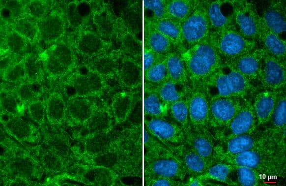 GPD1 antibody [HL1959] detects GPD1 protein at cell membrane and cytoplasm by immunofluorescent analysis.Sample: Caco-2 cells were fixed in ice-cold MeOH for 5 min.Green: GPD1 stained by GPD1 antibody [HL1959] (NBP3-25488) diluted at 1:500.Blue: Fluoroshield with DAPI . 