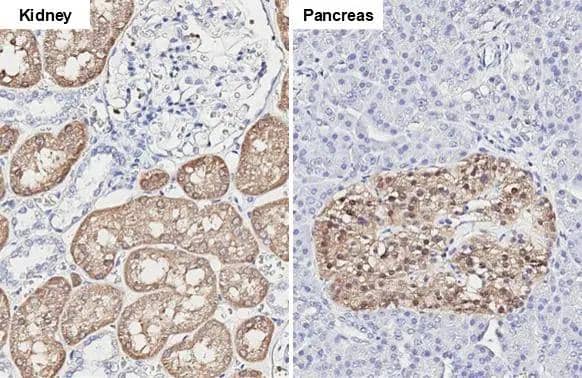 GPD1 antibody [HL1959] detects GPD1 protein by immunohistochemical analysis.Sample: Paraffin-embedded human tissues.GPD1 stained by GPD1 antibody [HL1959] (NBP3-25488) diluted at 1:100.Antigen Retrieval: Citrate buffer, pH 6.0, 15 min 