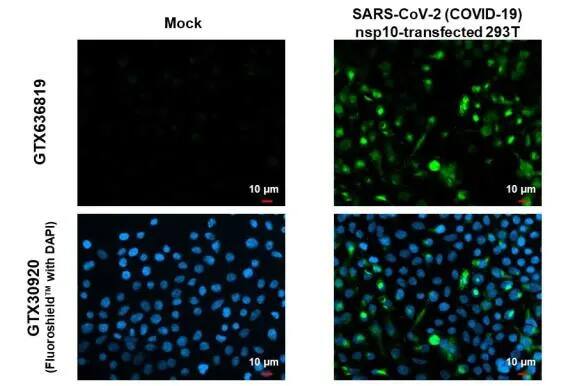 Immunocytochemistry/Immunofluorescence: SARS-CoV-2 NSP10 Antibody (HL1379) - Azide and BSA Free [NBP3-25489] - SARS-CoV-2 (COVID-19) nsp10 antibody [HL1379] detects SARS-CoV-2 (COVID-19) nsp10 protein by immunofluorescent analysis. Sample: Mock and transfected 293T cells were fixed in 4% paraformaldehyde at RT for 15 min. Green: SARS-CoV-2 (COVID-19) nsp10 stained by SARS-CoV-2 (COVID-19) nsp10 antibody [HL1379] (NBP3-25489) diluted at 1:500. Blue: Fluoroshield with DAPI .