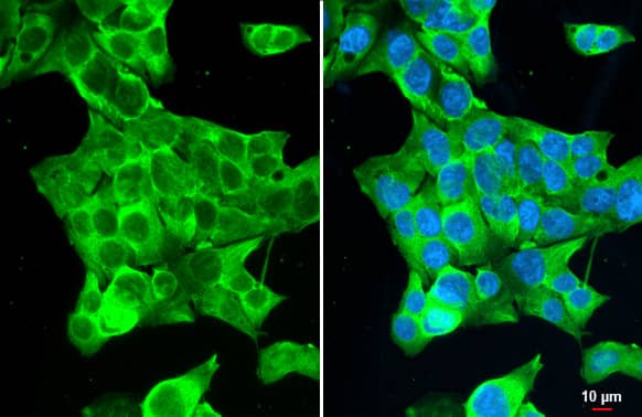 Immunocytochemistry/Immunofluorescence: GSPT1 Antibody (HL1345) - Azide and BSA Free [NBP3-25492] - GSPT1 antibody [HL1345] detects GSPT1 protein at cytoplasm by immunofluorescent analysis. Sample: HepG2 cells were fixed in 4% paraformaldehyde at RT for 15 min. Green: GSPT1 stained by GSPT1 antibody [HL1345] (NBP3-25492) diluted at 1:500. Blue: Fluoroshield with DAPI . Scale bar= 10um.