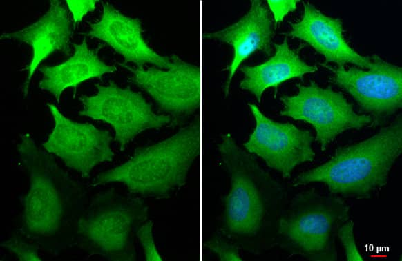 Immunocytochemistry/Immunofluorescence: GSPT1 Antibody (HL1346) - Azide and BSA Free [NBP3-25493] - GSPT1 antibody [HL1346] detects GSPT1 protein at cytoplasm by immunofluorescent analysis. Sample: HeLa cells were fixed in 4% paraformaldehyde at RT for 15 min. Green: GSPT1 stained by GSPT1 antibody [HL1346] (NBP3-25493) diluted at 1:500. Blue: Fluoroshield with DAPI .