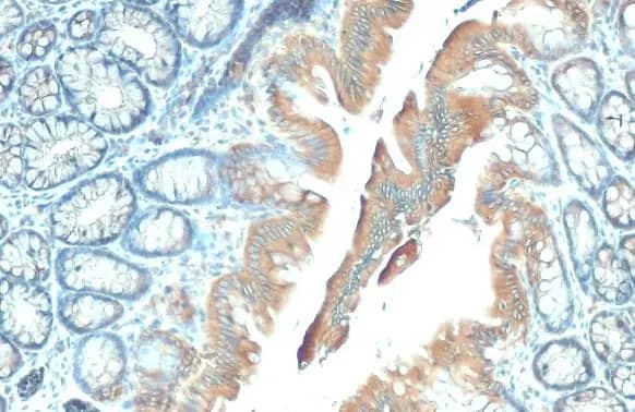 Immunohistochemistry-Paraffin: GSPT1 Antibody (HL1346) - Azide and BSA Free [NBP3-25493] - GSPT1 antibody [HL1346] detects GSPT1 protein at cytoplasm by immunohistochemical analysis. Sample: Paraffin-embedded rat colon. GSPT1 stained by GSPT1 antibody [HL1346] (NBP3-25493) diluted at 1:100. Antigen Retrieval: Citrate buffer, pH 6.0, 15 min