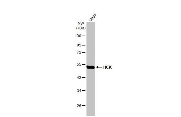 Western Blot: Hck Antibody (HL1673) - Azide and BSA Free [NBP3-25496] - Whole cell extract (30 ug) was separated by 10% SDS-PAGE, and the membrane was blotted with HCK antibody [HL1673] (NBP3-25496) diluted at 1:1000. The HRP-conjugated anti-rabbit IgG antibody was used to detect the primary antibody.