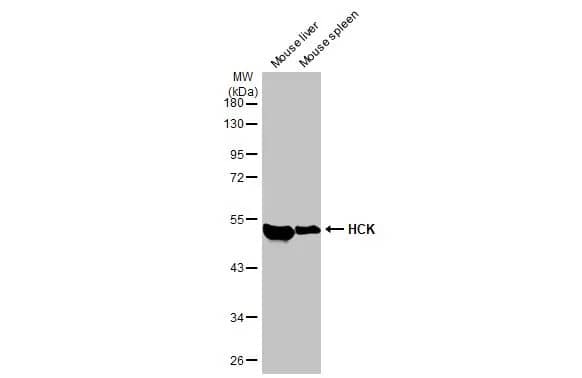 Western Blot: Hck Antibody (HL1673) - Azide and BSA Free [NBP3-25496] - Various tissue extracts (50 ug) were separated by 10% SDS-PAGE, and the membrane was blotted with HCK antibody [HL1673] (NBP3-25496) diluted at 1:1000. The HRP-conjugated anti-rabbit IgG antibody was used to detect the primary antibody.