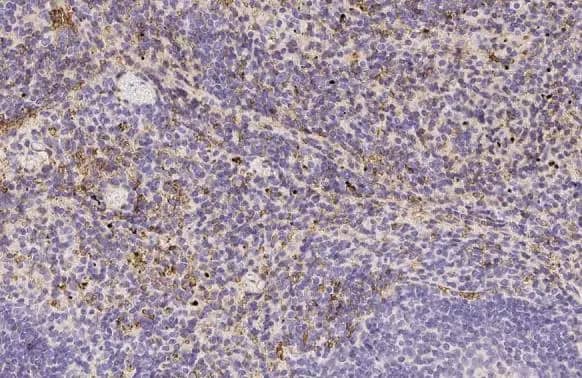 Immunohistochemistry-Paraffin: Hemoglobin epsilon Antibody (HL2458) - Azide and BSA Free [NBP3-25500] - Hemoglobin epsilon antibody [HL2458] detects secreted Hemoglobin epsilon protein by immunohistochemical analysis. Sample: Paraffin-embedded mouse spleen. Hemoglobin epsilon stained by Hemoglobin epsilon antibody [HL2458] (NBP3-25500) diluted at 1:100. Antigen Retrieval: Citrate buffer, pH 6.0, 15 min