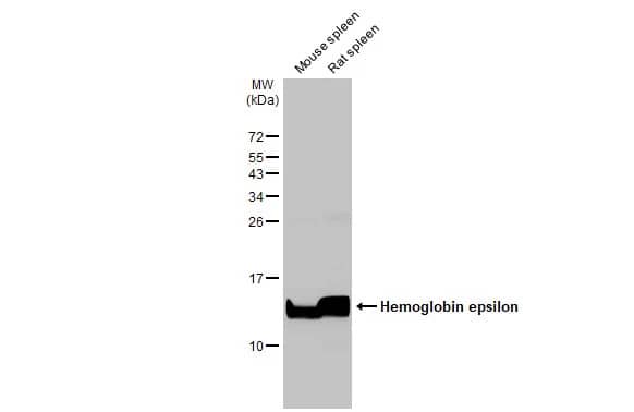 <b>Orthogonal Strategies Validation. </b>Western Blot: Hemoglobin epsilon Antibody (HL2458) - Azide and BSA Free [NBP3-25500] - Various tissue extracts (50 ug) were separated by 15% SDS-PAGE, and the membrane was blotted with Hemoglobin epsilon antibody [HL2458] (NBP3-25500) diluted at 1:5000. The HRP-conjugated anti-rabbit IgG antibody was used to detect the primary antibody.