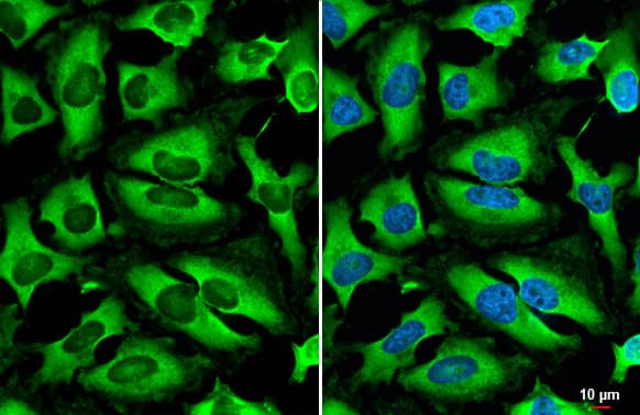 Immunocytochemistry/Immunofluorescence: HGS Antibody (HL1730) - Azide and BSA Free [NBP3-25503] - HGS antibody [HL1730] detects HGS protein at cytoplasm by immunofluorescent analysis. Sample: HeLa cells were fixed in 4% paraformaldehyde at RT for 15 min. Green: HGS stained by HGS antibody [HL1730] (NBP3-25503) diluted at 1:250. Blue: Fluoroshield with DAPI .