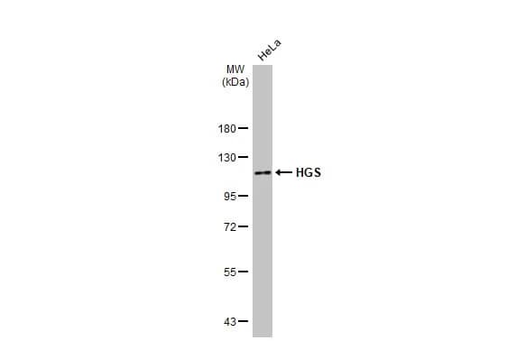 Western Blot: HGS Antibody (HL1730) - Azide and BSA Free [NBP3-25503] - Whole cell extract (30 ug) was separated by 7.5% SDS-PAGE, and the membrane was blotted with HGS antibody [HL1730] (NBP3-25503) diluted at 1:1000. The HRP-conjugated anti-rabbit IgG antibody was used to detect the primary antibody.