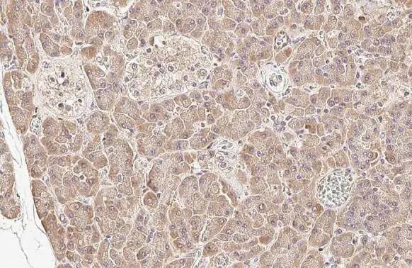 Immunohistochemistry-Paraffin: HGS Antibody (HL1730) - Azide and BSA Free [NBP3-25503] - HGS antibody [HL1730] detects HGS protein at cytoplasm by immunohistochemical analysis. Sample: Paraffin-embedded cat pancreas. HGS stained by HGS antibody [HL1730] (NBP3-25503) diluted at 1:100. Antigen Retrieval: Citrate buffer, pH 6.0, 15 min