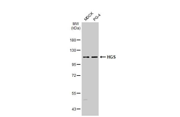 Western Blot: HGS Antibody (HL1730) - Azide and BSA Free [NBP3-25503] - Various whole cell extracts (30 ug) were separated by 7.5% SDS-PAGE, and the membrane was blotted with HGS antibody [HL1730] (NBP3-25503) diluted at 1:1000. The HRP-conjugated anti-rabbit IgG antibody was used to detect the primary antibody.