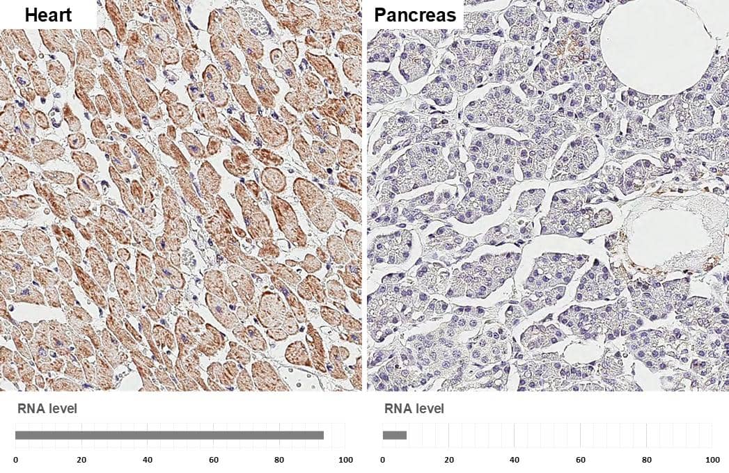 <b>Orthogonal Strategies Validation. </b>SDHB antibody [HL2251] detects SDHB protein by immunohistochemical analysis.Sample: Paraffin-embedded human tissues.SDHB stained by SDHB antibody [HL2251] (NBP3-25504) diluted at 1:200.Antigen Retrieval: Citrate buffer, pH 6.0, 15 min 