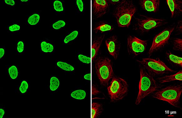 Immunocytochemistry/Immunofluorescence: hnRNP A2B1 Antibody (HL1706) - Azide and BSA Free [NBP3-25508] - hnRNP A2B1 antibody [HL1706] detects hnRNP A2B1 protein by immunofluorescent analysis. Sample: U2OS cells were fixed in 4% paraformaldehyde at RT for 15 min. Green: hnRNP A2B1 stained by hnRNP A2B1 antibody [HL1706] (NBP3-25508) diluted at 1:500. Red: alpha Tubulin, a cytoskeleton marker, stained by alpha Tubulin antibody [GT114] diluted at 1:1000.