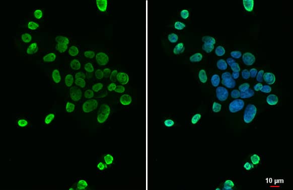 Immunocytochemistry/Immunofluorescence: hnRNP A2B1 Antibody (HL1706) - Azide and BSA Free [NBP3-25508] - hnRNP A2B1 antibody [HL1706] detects hnRNP A2B1 protein at nucleus by immunofluorescent analysis. Sample: HepG2 cells were fixed in 4% paraformaldehyde at RT for 15 min. Green: hnRNP A2B1 stained by hnRNP A2B1 antibody [HL1706] (NBP3-25508) diluted at 1:500. Blue: Fluoroshield with DAPI .