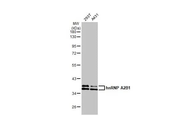 Western Blot: hnRNP A2B1 Antibody (HL1706) - Azide and BSA Free [NBP3-25508] - Various whole cell extracts (30 ug) were separated by 10% SDS-PAGE, and the membrane was blotted with hnRNP A2B1 antibody [HL1706] (NBP3-25508) diluted at 1:100000. The HRP-conjugated anti-rabbit IgG antibody was used to detect the primary antibody.