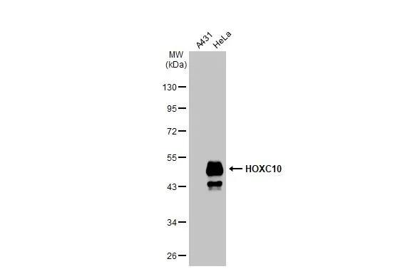 Western Blot: HOXC10 Antibody (HL1234) - Azide and BSA Free [NBP3-25509] - Various whole cell extracts (30 ug) were separated by 10% SDS-PAGE, and the membrane was blotted with Homeobox C10 antibody [HL1234] (NBP3-25509) diluted at 1:1000. The HRP-conjugated anti-rabbit IgG antibody was used to detect the primary antibody.