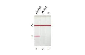Lateral Flow Assay: HPV16 E7 Antibody (HL1821) - Azide and BSA Free [NBP3-25511] - Detection of Human Papillomavirus type 16 E7 protein by lateral flow assay using the monoclonal antibody pair. Capture: Human Papillomavirus type 16 E7 antibody (NBP3-25510 [HL1647]) Detection: Human Papillomavirus type 16 E7 antibody (NBP3-25511 [HL1821]) Samples (10 ng) : 1. HPV16 E7 protein 2. HPV18 E7 protein 3. Lysis buffer