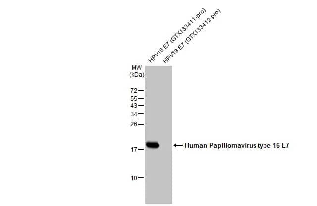 Western Blot: HPV16 E7 Antibody (HL1821) - Azide and BSA Free [NBP3-25511] - Human papillomavirus protein (100 ng) were separated by 15% SDS-PAGE, and the membrane was blotted with Human Papillomavirus type 16 E7 antibody [HL1821] (NBP3-25511) diluted at 1:1000. The HRP-conjugated anti-rabbit IgG antibody was used to detect the primary antibody.